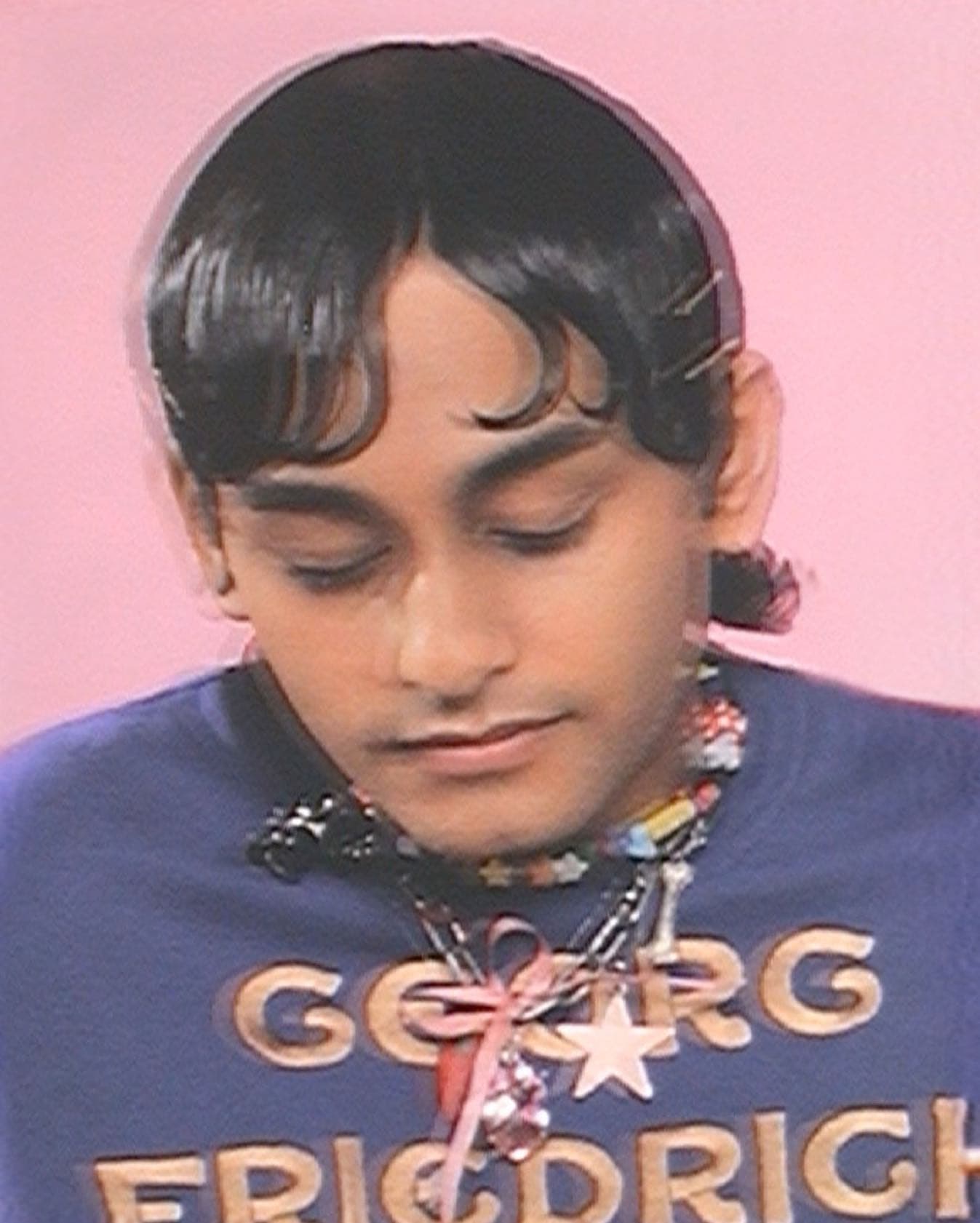 Acne Face - Sharna Osborne